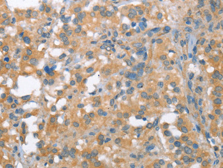 NLRP7 Polyclonal Antibody Store at -20°C