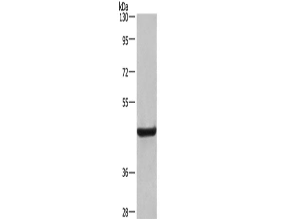 CD107b Polyclonal Antibody Store at -20°C