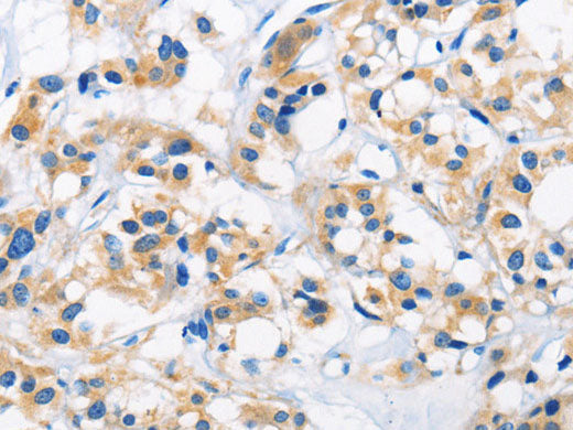 HK1 Polyclonal Antibody Store at -20°C