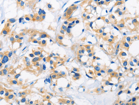 HK1 Polyclonal Antibody Store at -20°C