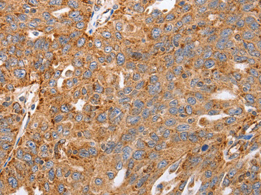 MAP2K5 Polyclonal Antibody Store at -20°C