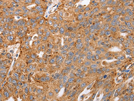 MAP2K5 Polyclonal Antibody Store at -20°C
