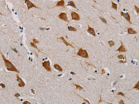 CMC4 Polyclonal Antibody