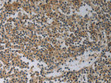 SLC4A7 Polyclonal Antibody