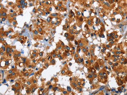 ARNTL Polyclonal Antibody Store at -20°C