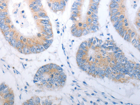 PAK1 Polyclonal Antibody Store at -20°C