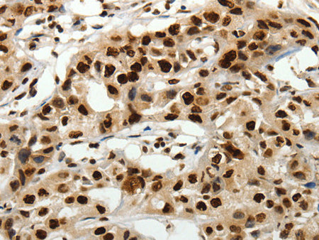 SCN1A Polyclonal Antibody Store at -20°C