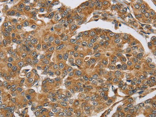 ERK 3 Polyclonal Antibody Store at -20°C
