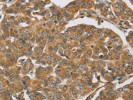 ERK 3 Polyclonal Antibody Store at -20°C