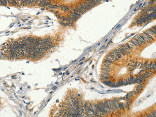 CIB1 Polyclonal Antibody Store at -20°C