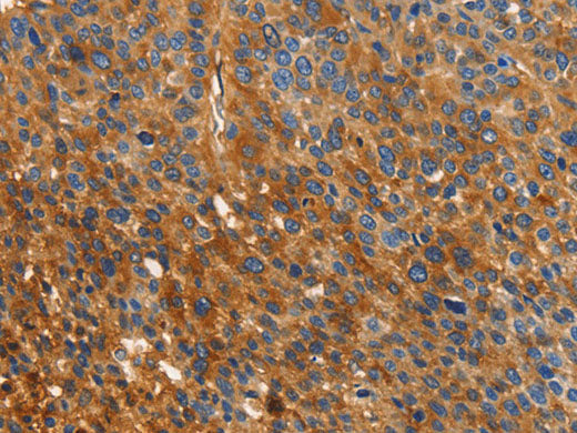 ORM2 Polyclonal Antibody Store at -20°C