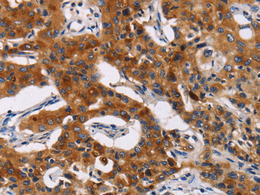 MSLN Polyclonal Antibody Store at -20°C