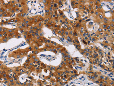 MSLN Polyclonal Antibody Store at -20°C