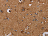 DISC1 Polyclonal Antibody Store at -20°C