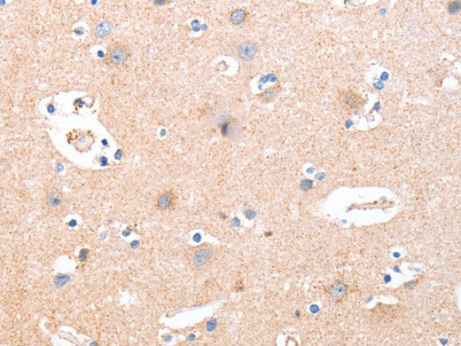 B3GAT1 Polyclonal Antibody Store at -20°C