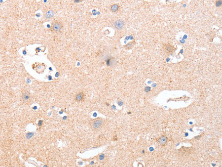 B3GAT1 Polyclonal Antibody Store at -20°C