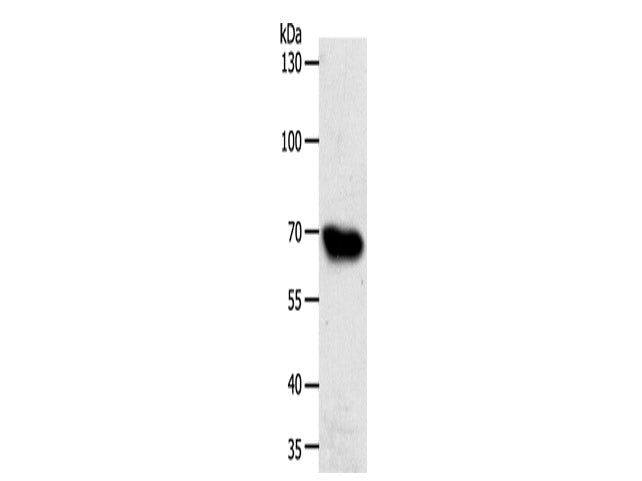 ABCG1 Polyclonal Antibody Store at -20°C