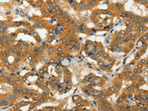 ADCY3 Polyclonal Antibody Store at -20°C