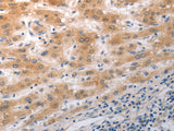 NQO2 Polyclonal Antibody Store at -20°C