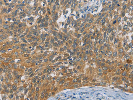 DIO1 Polyclonal Antibody Store at -20°C