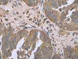FANCG Polyclonal Antibody