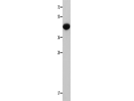 MAP2K6 Polyclonal Antibody Store at -20°C