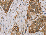 MVK Polyclonal Antibody