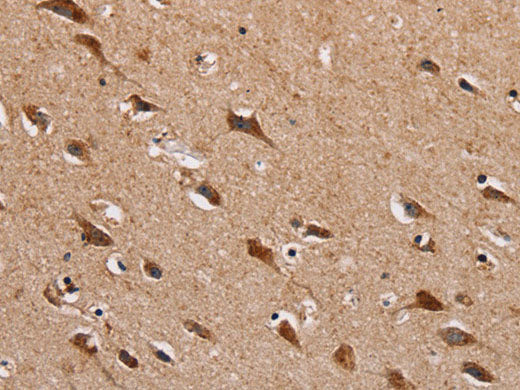 HTR3C Polyclonal Antibody Store at -20°C