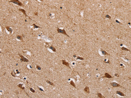 HTR3C Polyclonal Antibody Store at -20°C