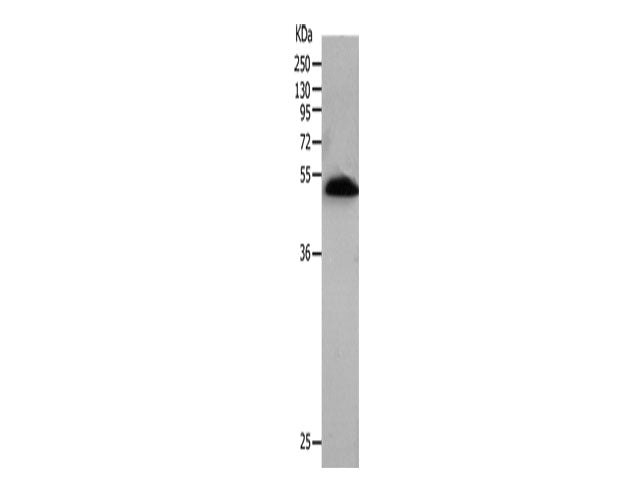 BPIFB2 Polyclonal Antibody Store at -20°C