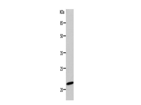 DUT Polyclonal Antibody Store at -20°C