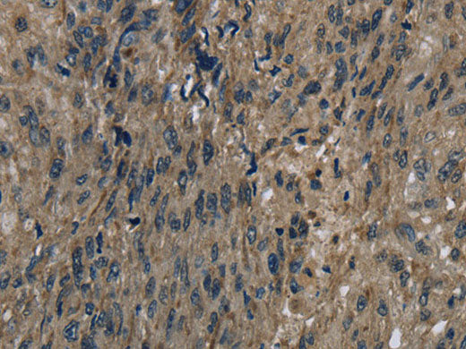 FTO Polyclonal Antibody Store at -20°C