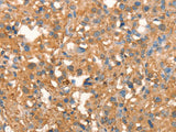CRELD1 Polyclonal Antibody Store at -20°C