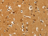 PFKFB1 Polyclonal Antibody