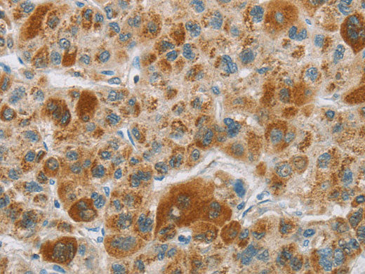 CYP27A1 Polyclonal Antibody