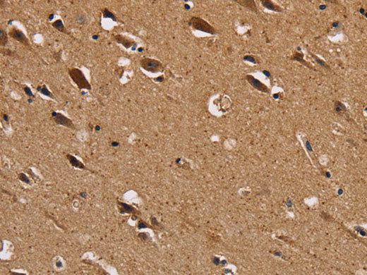 NDUFS1 Polyclonal Antibody Store at -20°C