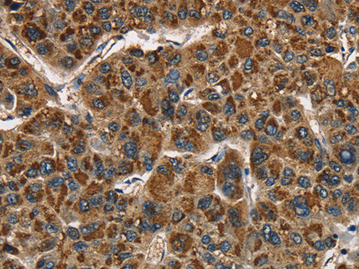 CAT Polyclonal Antibody Store at -20°C