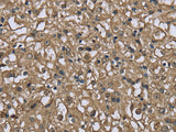 FBP1 Polyclonal Antibody Store at -20°C