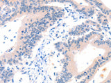 ITGA6 Polyclonal Antibody Store at -20°C