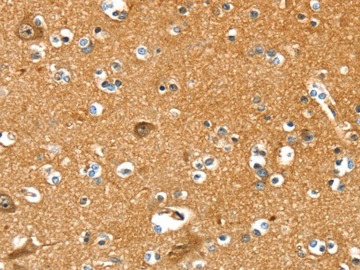 PYGL Polyclonal Antibody Store at -20°C