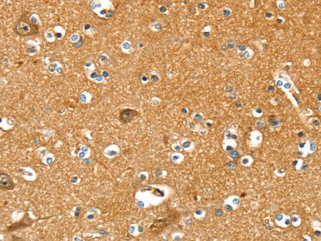 PYGL Polyclonal Antibody Store at -20°C