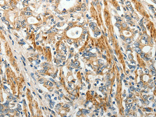 E-Selectin Polyclonal Antibody Reactivity Human