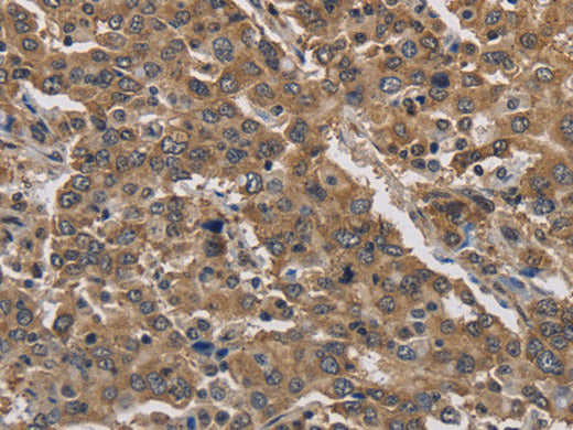 JAG2 Polyclonal Antibody Store at -20°C