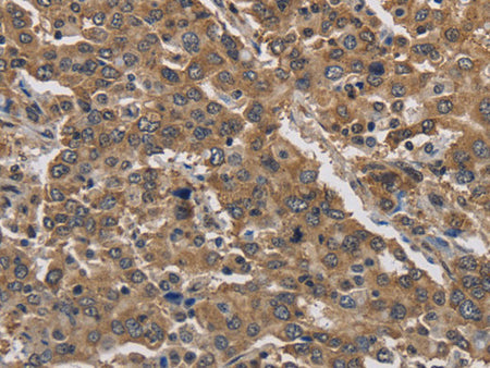 JAG2 Polyclonal Antibody Store at -20°C