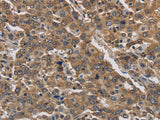 JAG2 Polyclonal Antibody Store at -20°C