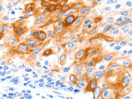 SLC2A11 Polyclonal Antibody