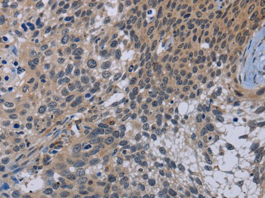 CDC16 Polyclonal Antibody Store at -20°C