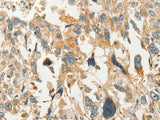 SLC11A2 Polyclonal Antibody Store at -20°C