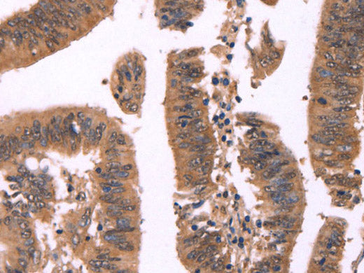 FBXO31 Polyclonal Antibody Store at -20°C