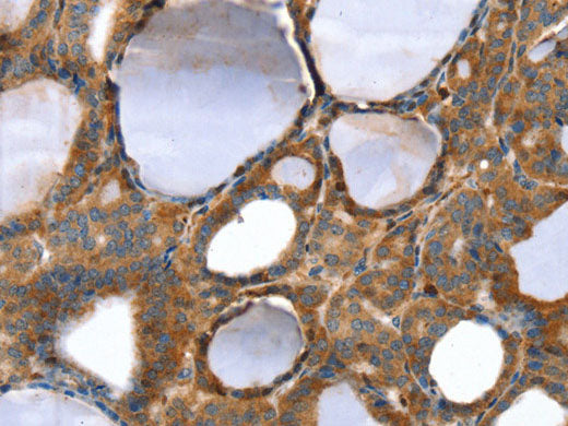 TAGLN Polyclonal Antibody Store at -20°C